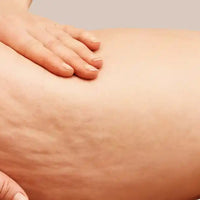 Cellulite amoseeds specialiste des super aliments bio (2)